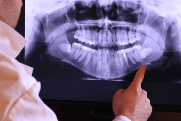 Best Emergency Root Canal Therapy in Auburn, KY