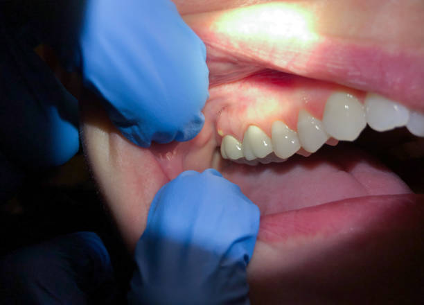 Best Emergency Cosmetic Dentistry (e.g., broken veneers) in Auburn, KY